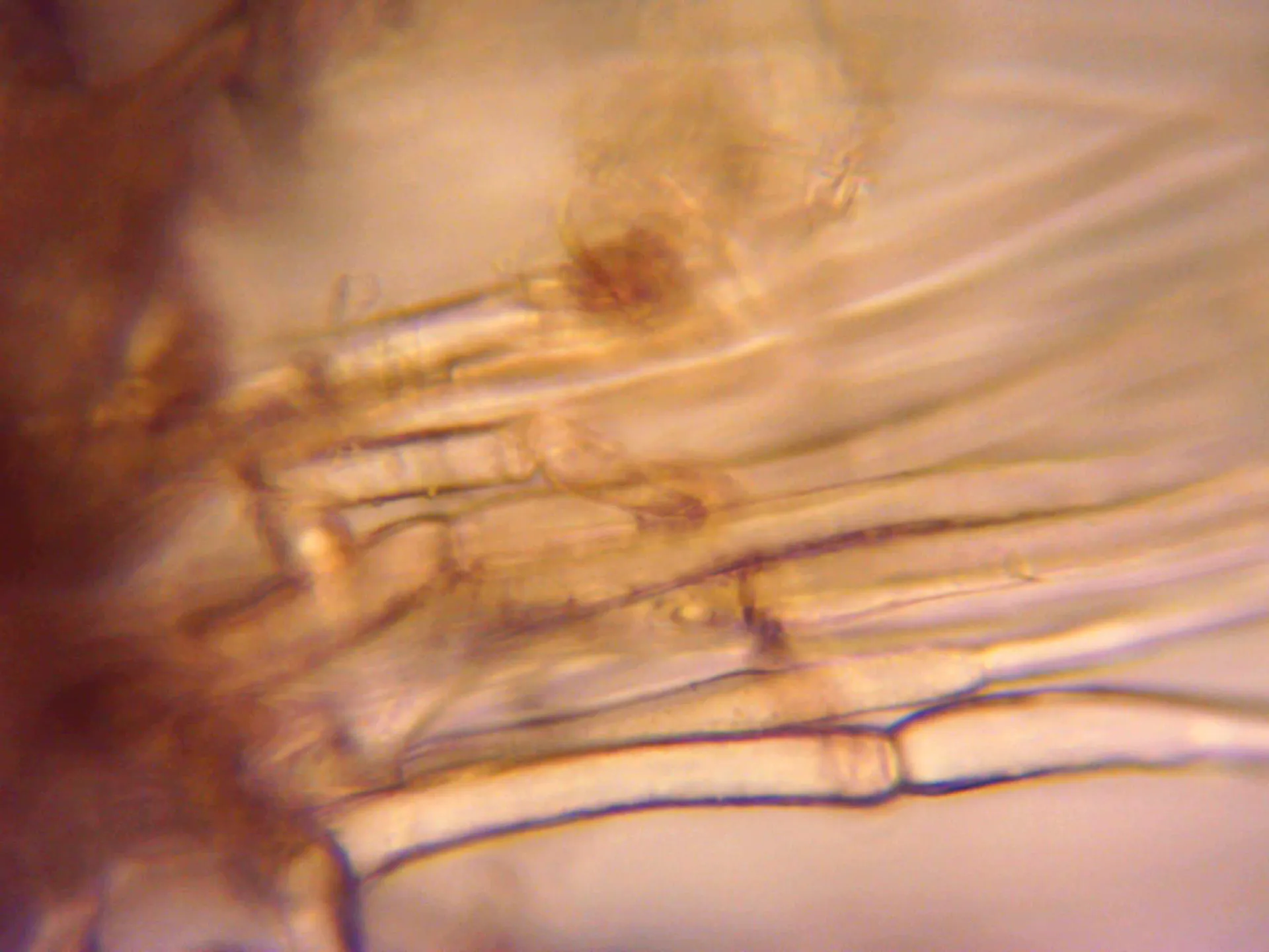 Microscopía de Tricholoma psammopus - 15 - Estipitipellis X 1000 2